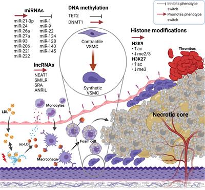 Epigenetic Regulation of Vascular Smooth Muscle Cell Phenotype Switching in Atherosclerotic Artery Remodeling: A Mini-Review